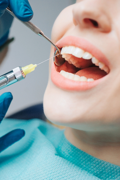 Affordable compared to veneers or crowns.