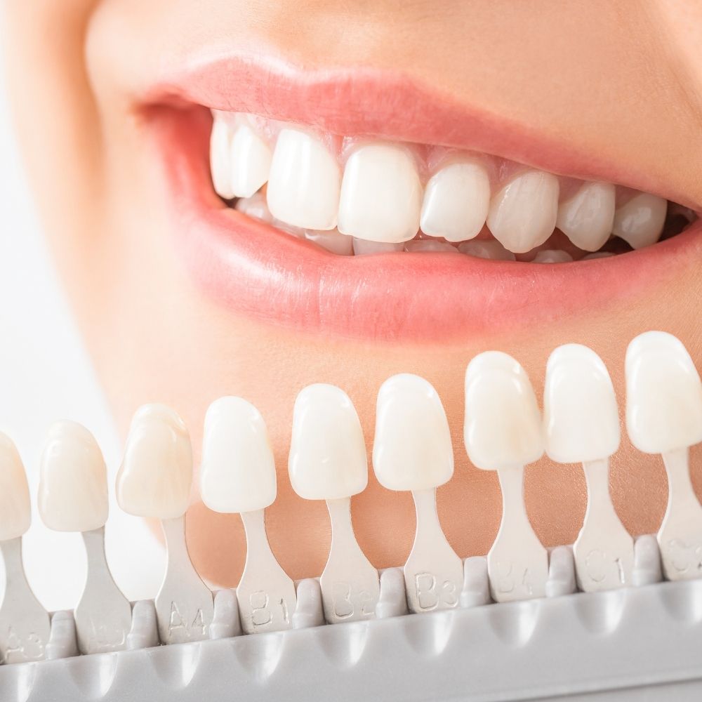 Benefits of Dental Crowns at White Orchid Dentistry