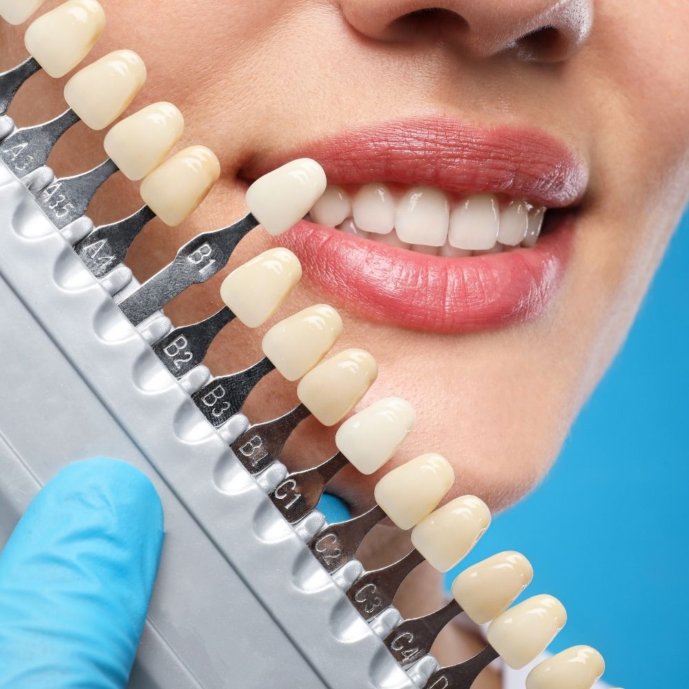 Benefits of Dental Crowns at White Orchid Dentistry