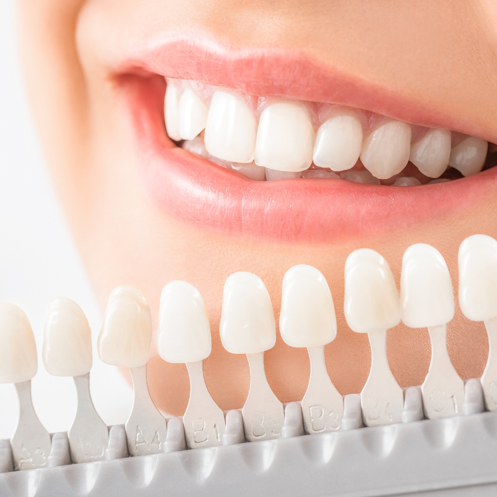 Benefits of Orthodontics at White Orchid Dentistry