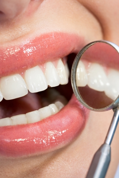 Brighten stained or discoloured teeth safely.