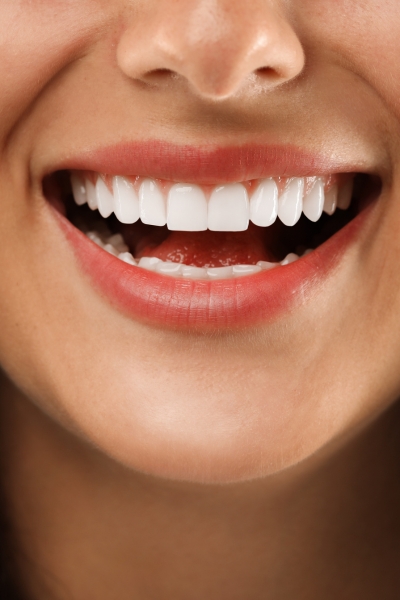 Create uniformity in tooth shape and size.