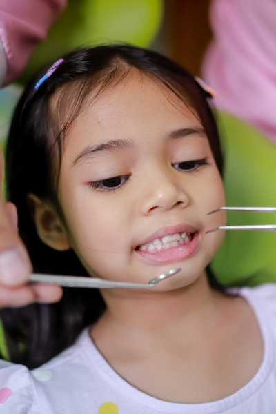 Deep grooves in molars where food and bacteria collect