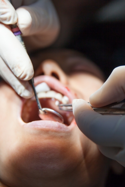 Detect and treat serious conditions early, such as oral cancer.