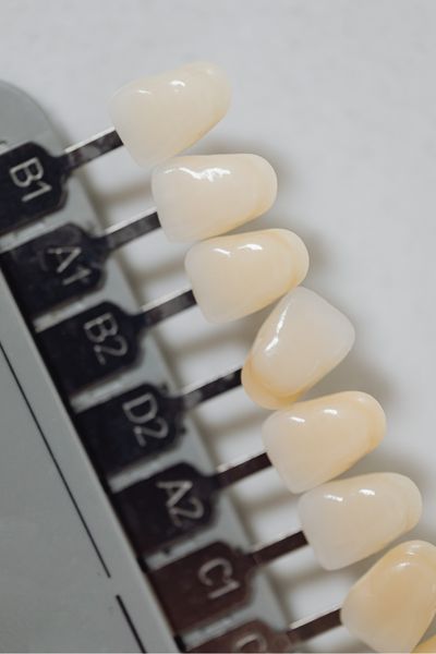 Exposed tooth structure may cause pain or sensitivity