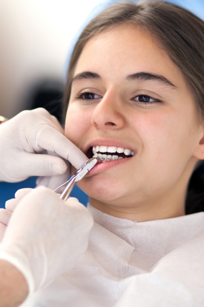 Fewer dental visits compared to braces.
