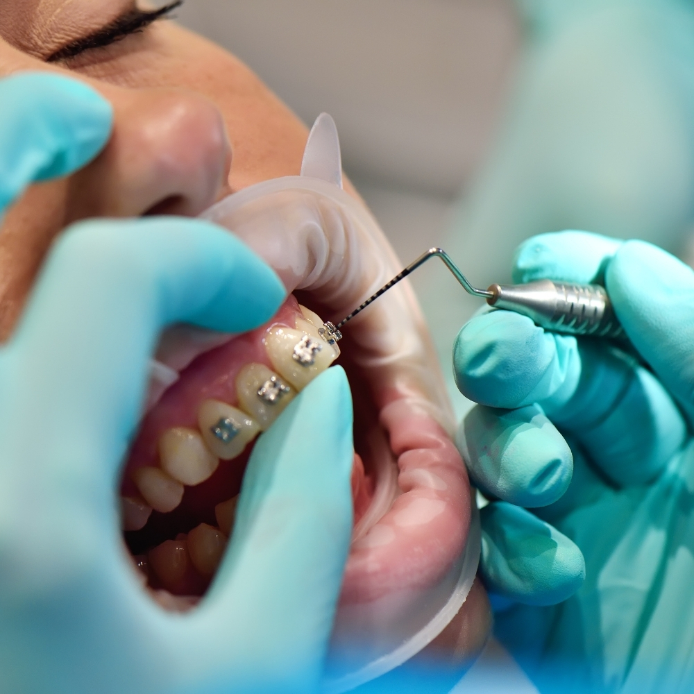 Gentle Emergency Dental Care for Children at White Orchid Dentistry