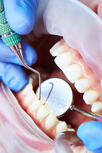 Jaw injuries and concussions.