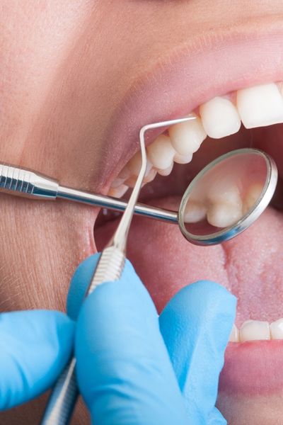Looks and feels like real teeth.