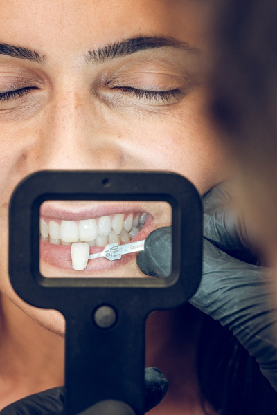 Preventing facial sagging caused by missing teeth.