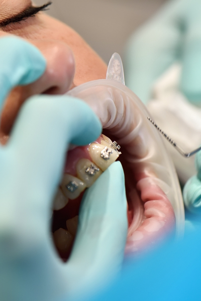 Protect against gum disease and bone loss.
