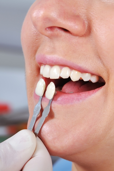 Restore damaged teeth to full strength and function