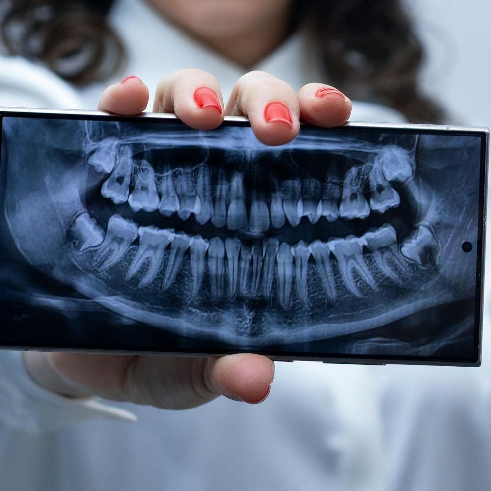 Risk Factors for Oral Cancer