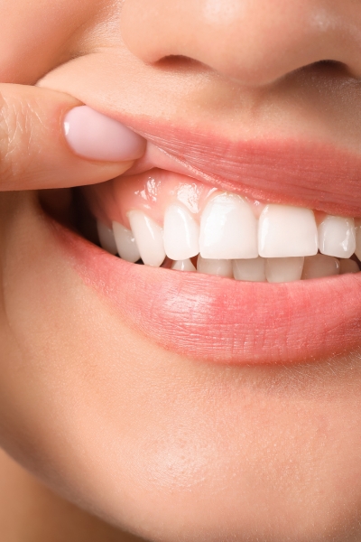 Safer: Dentist-supervised to protect your teeth and gums