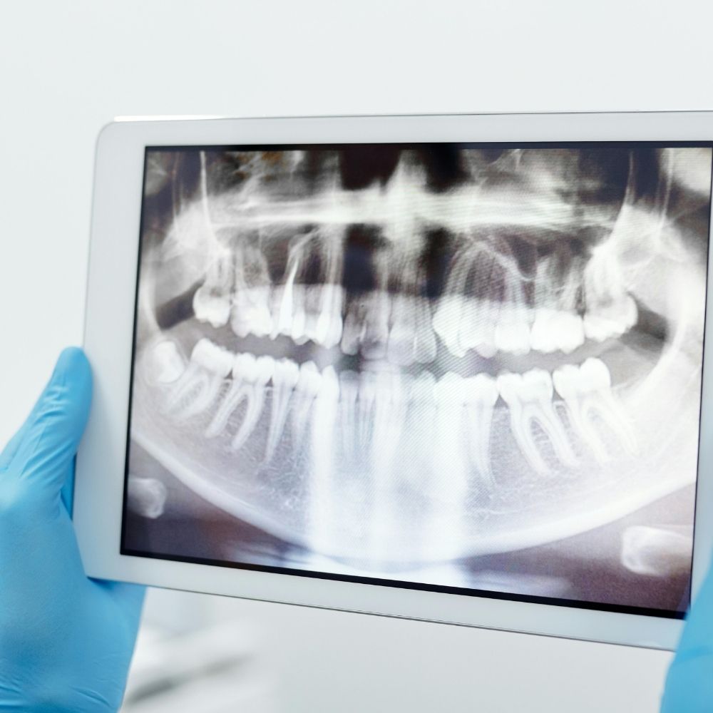 Severe Toothache Relief at White Orchid Dentistry