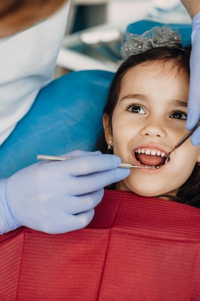 Teeth grinding or clenching (bruxism).