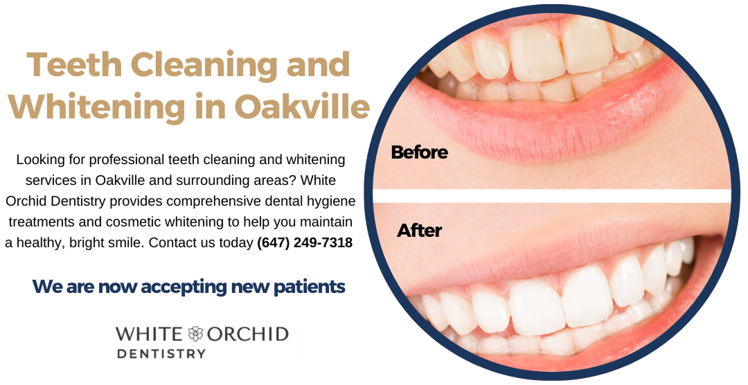 Teeth whitening and cleaning oakville
