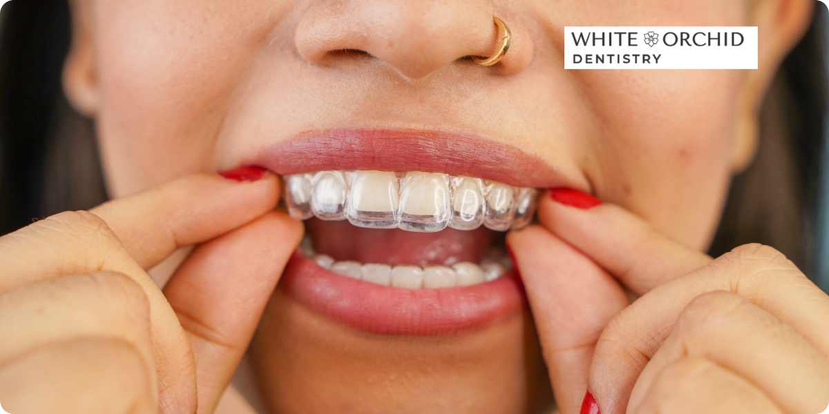 The 3 Invisalign Myths in Oakville That Cost Families Thousands