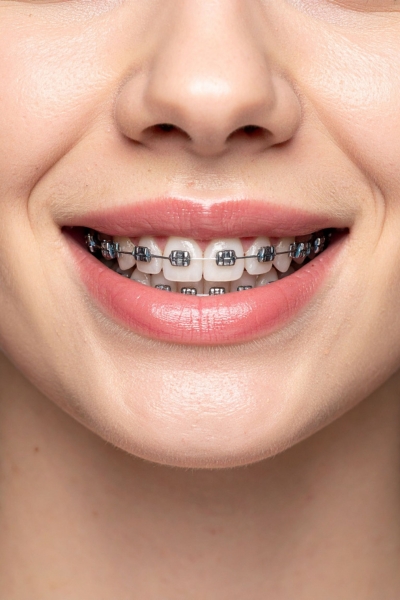 Uneven tooth wear.