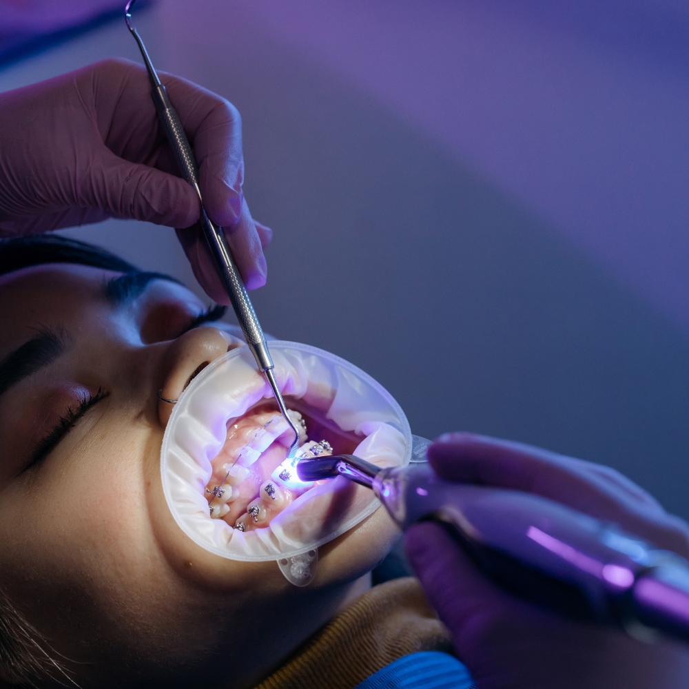 What to Do During a Dental Emergency (Step-by-Step)