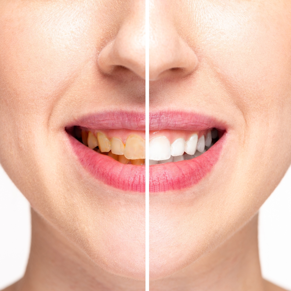 What to Expect Before, During & After Surgery