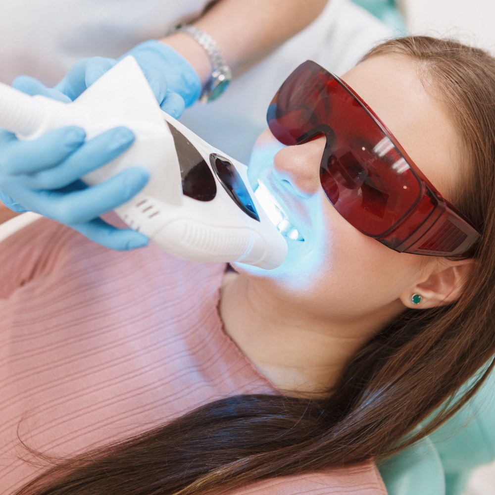 What to Expect During a Whitening Treatment
