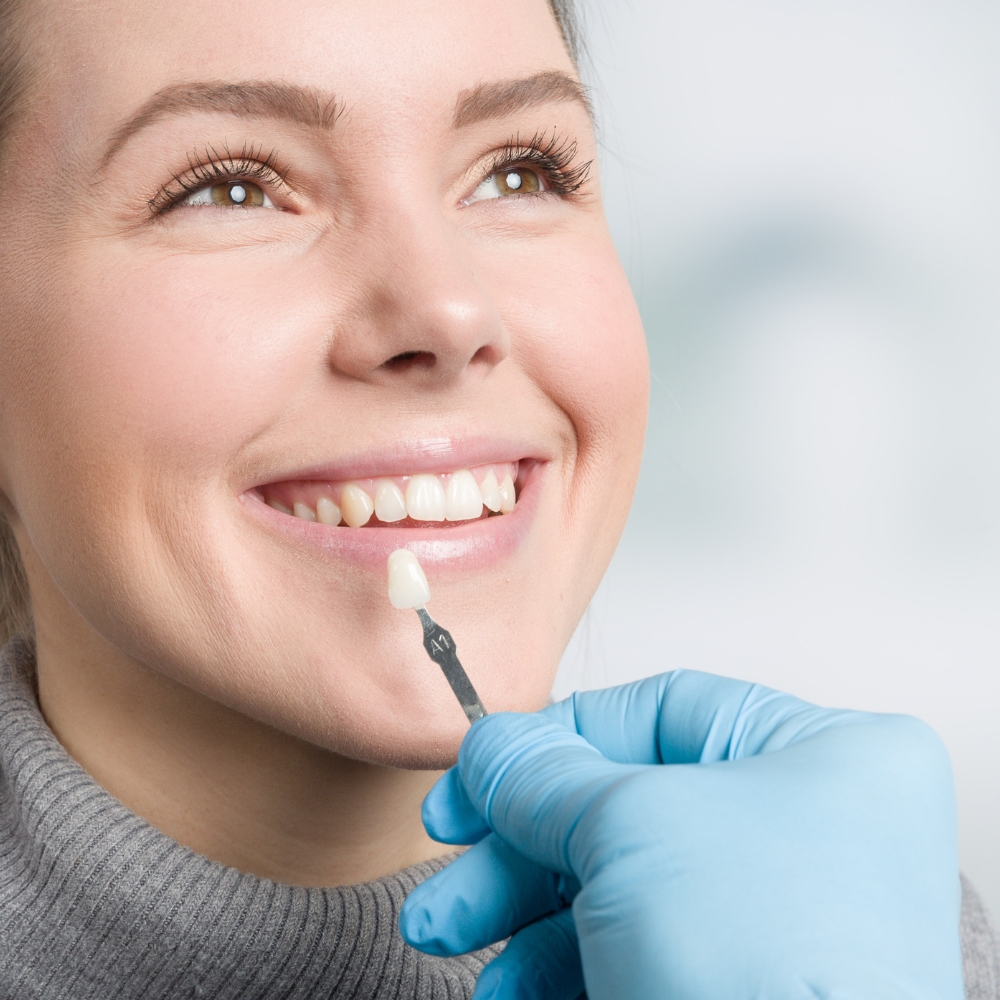 What to Expect During the Veneers Process