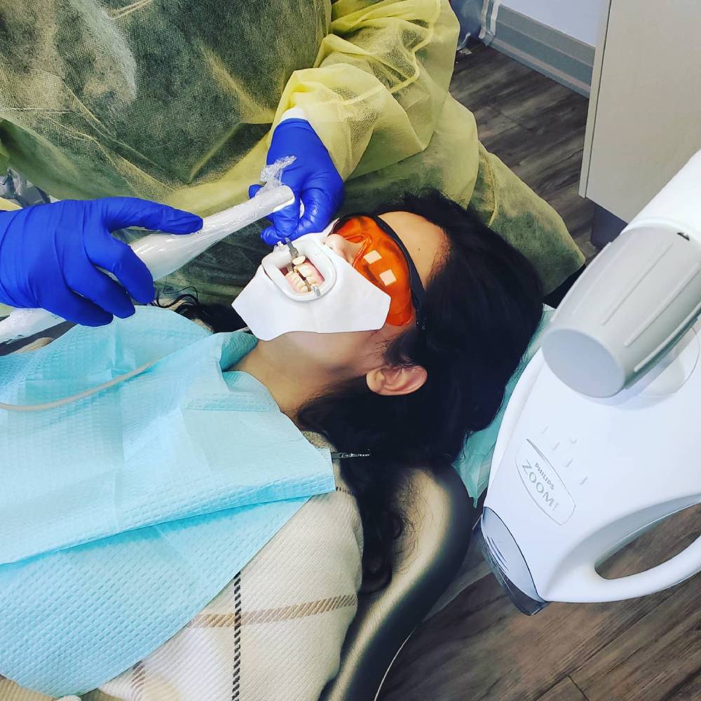 Why Opt for Sealants and Fluoride
