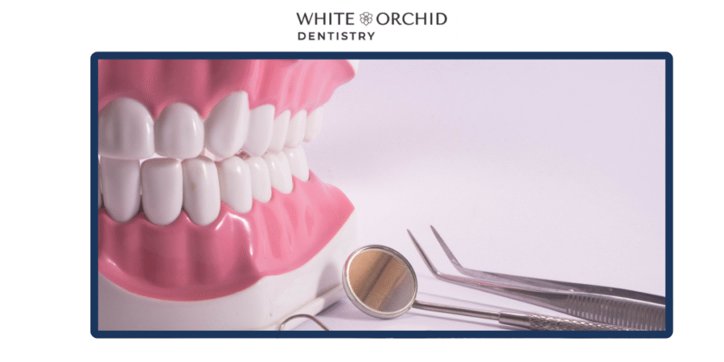 dental bonding cost Oakville