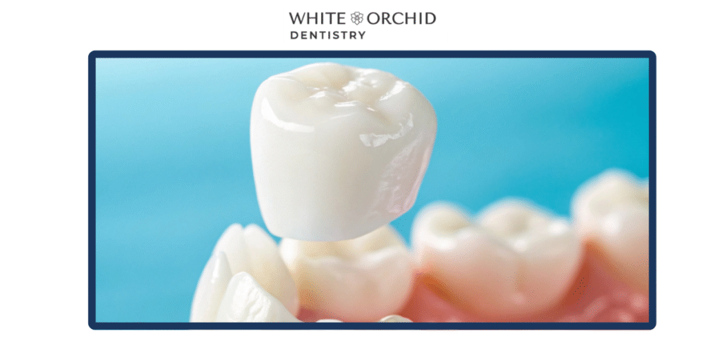 types of dental crowns in Oakville ontario